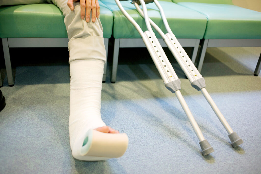 man with leg in cast and on crutches